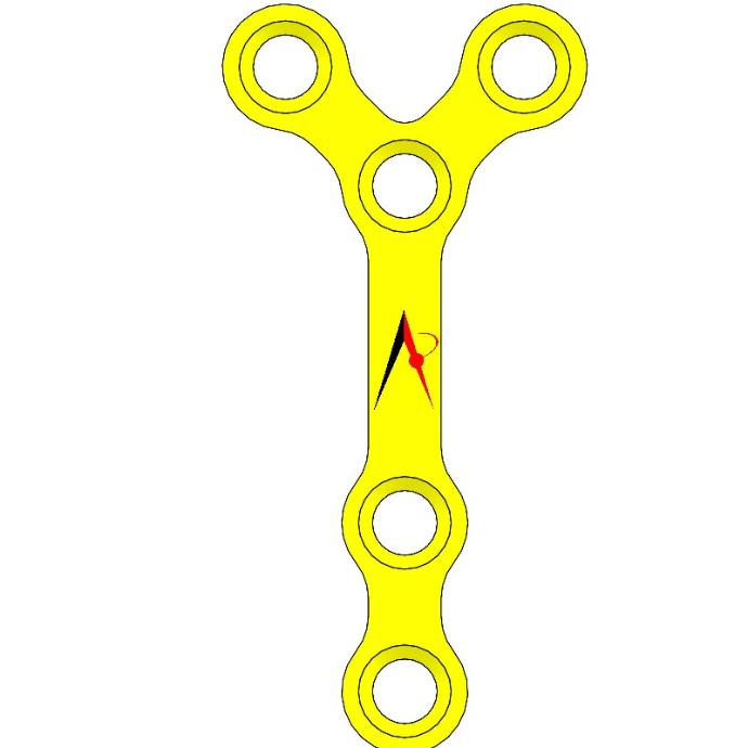 MINI PLATE Y WITH BRIDGE (1.0mm)